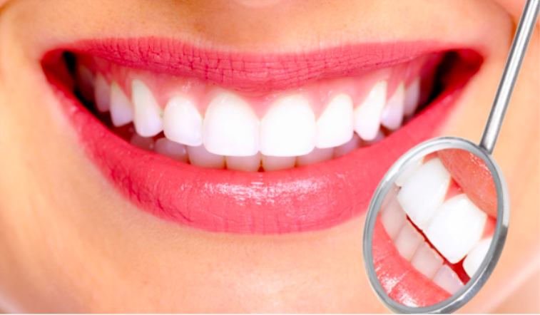 Diş Teli Temizliği Neden Önemlidir?